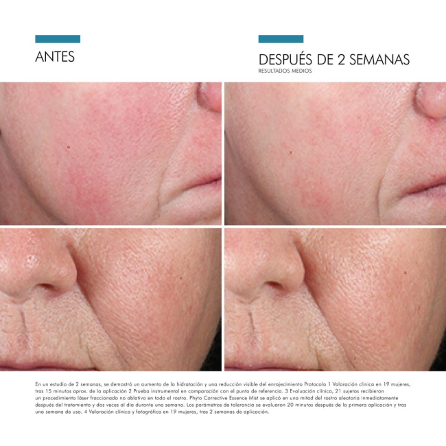 Comprar Skinceuticals Phyto Essence Mist al Mejor Precio | Quierofarma