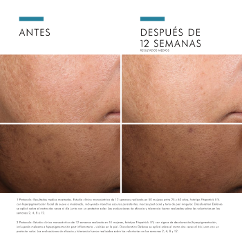 Comprar Skinceuticals Discoloration Defense al Mejor Precio | Quierofarma