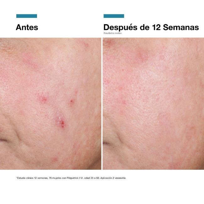 Comprar Advanced RGN-6 SkinCeuticals al Mejor Precio | Quierofarma