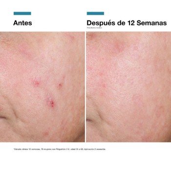 Comprar Advanced RGN-6 SkinCeuticals al Mejor Precio | Quierofarma