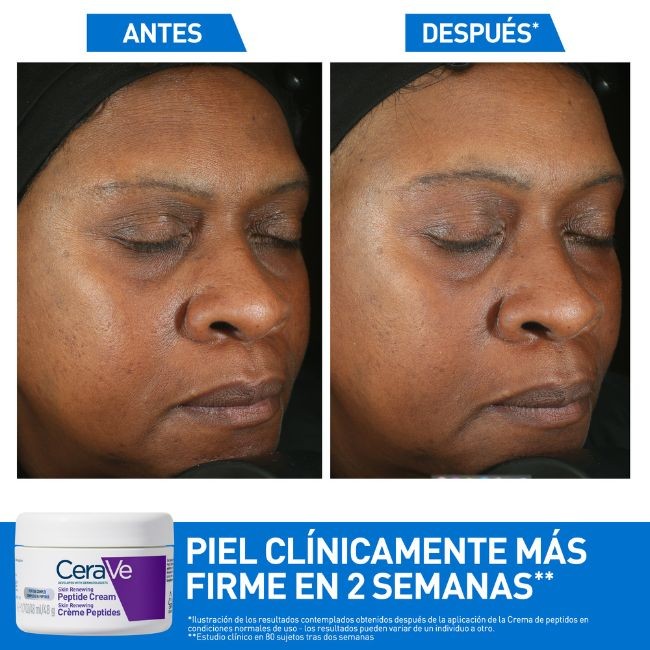 Comprar Skin Renewing Crema con Péptidos al Mejor Precio | Quierofarma